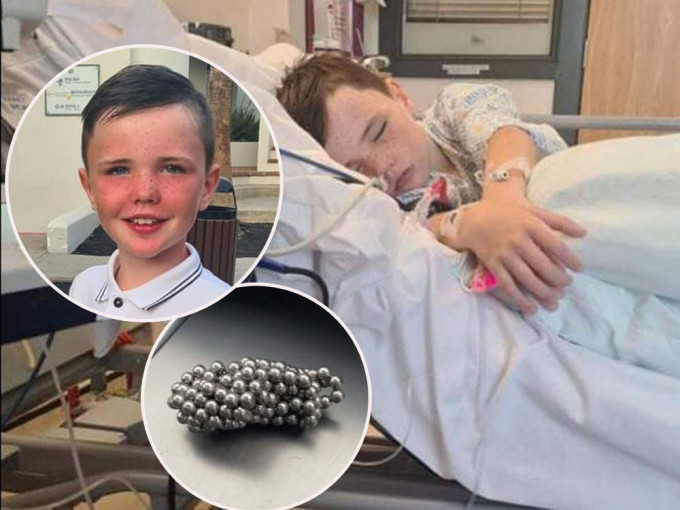 英9歲童仿抖音挑戰吞磁珠險死。FB圖