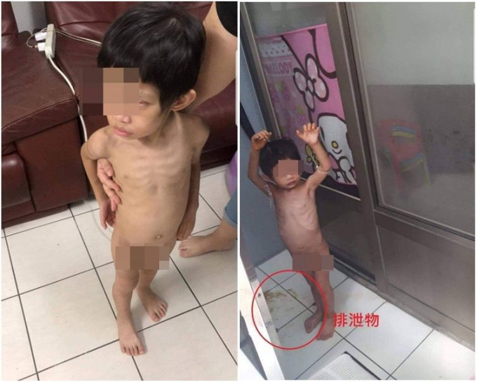 男童日前被發現骨瘦如柴赤裸被綁在露台上。
