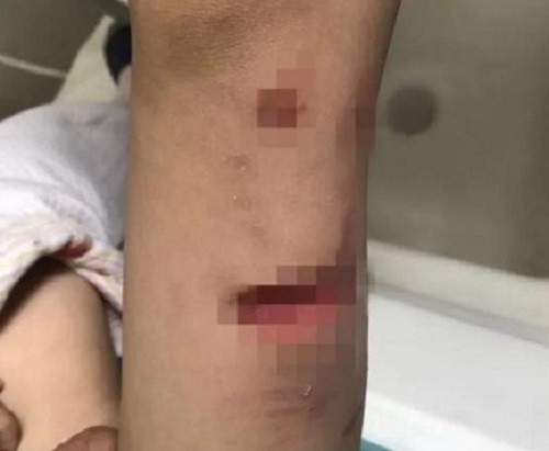老人和小孩被兩隻狗咬傷。 網上圖片