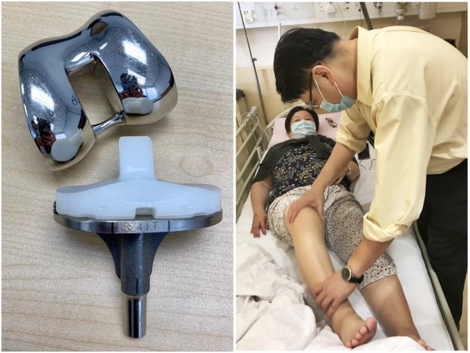图左：人工关节。图右：张坚颖为病人作手术前检查。相片由宝血医院（明爱）提供