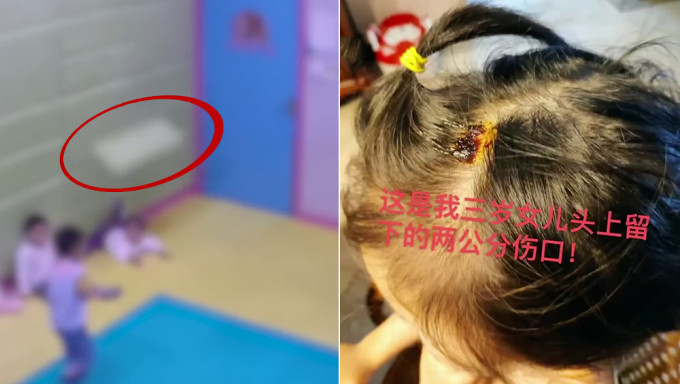 幼儿园墙身木板掉下女童被砸破头，家长指幼儿园未有道歉亦未有整改仍在上课。