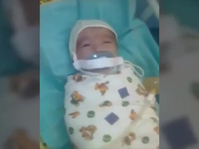 俄罗斯12周大男婴在医院被塞奶嘴封胶纸事件，警方已介入调查。(网图)