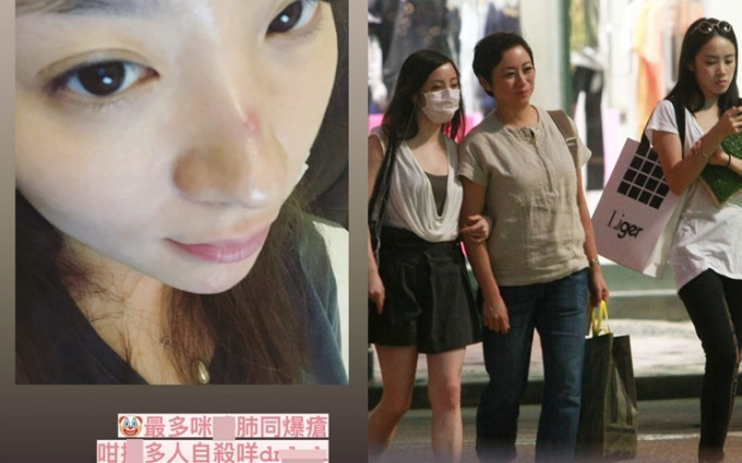 謝寧同大女岑寧童感情唔錯(左1戴口罩)，傳她自殺入院，今日岑寧童喺社交網爆粗否認傳聞。