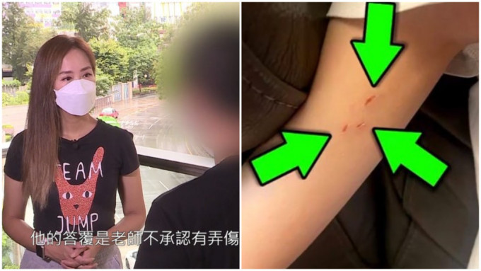 東張西望丨小三生疑遭老師暴力對待 指甲直插入肉留3指血痕校方冷處理