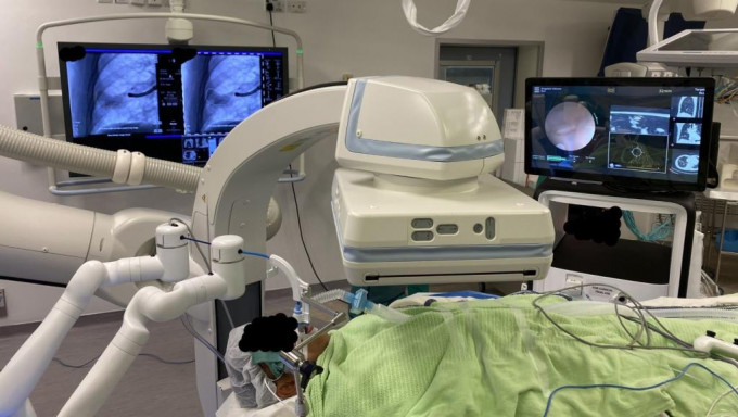 中大成功完成混合手术室机械人辅助支气管镜检查手术。中大图片
