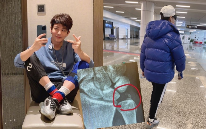 陈晓东为参与真人骚努力排练，在机场被发现手戴护具才透露伤势。