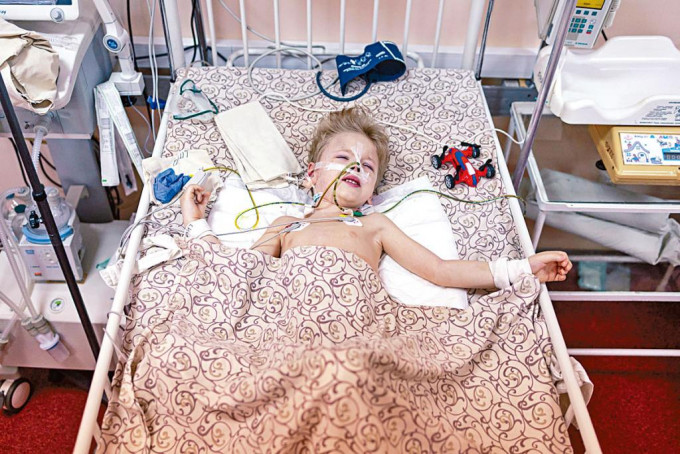 三歲男孩迪馬在馬里烏波爾炮擊中受傷，在附近城市的醫院治療。