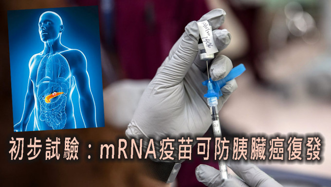 初步研究试验指mRNA疫苗可防胰脏癌复发。