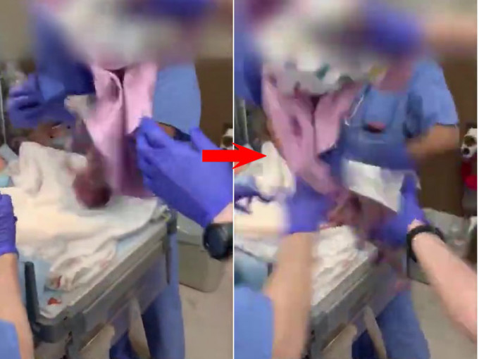 三名醫護人員正在清洗擦拭初生嬰兒的身體，期間醫生的動作似乎有些粗魯，將嬰兒的頭部朝下，跌在手術台上，差點還跌落到地上。(網圖)
