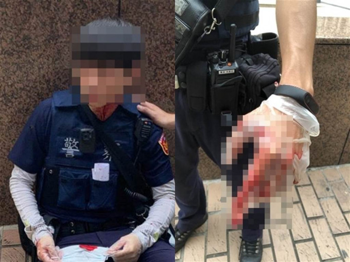 2名警员分别颈部及手部受伤。网上图片