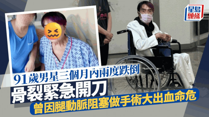 91歲男星又出事！三個月內兩度跌倒致骨裂緊急開刀 曾因腿動脈阻塞做手術大出血命危