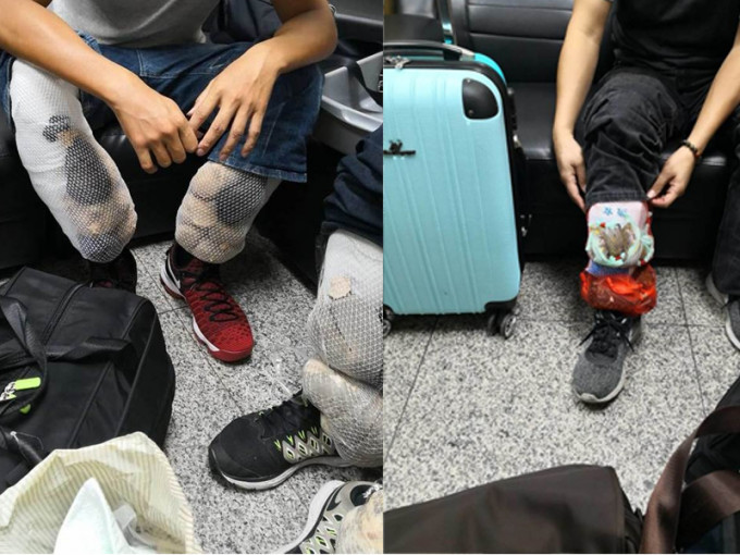 3名闖關旅客利用透氣網狀彈性棉罩，將活體動物綁在腿部。（網圖）