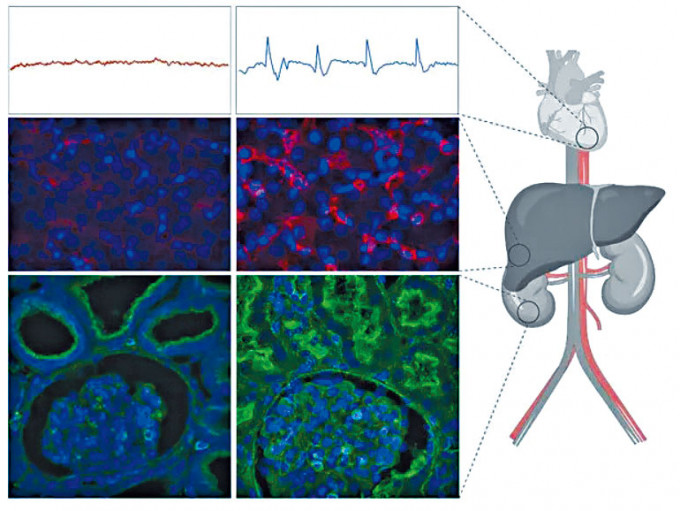 （上至下）左边为死猪的心电图、肝细胞、肾脏细胞影像；右边为使用了OrganEx技术的影像。