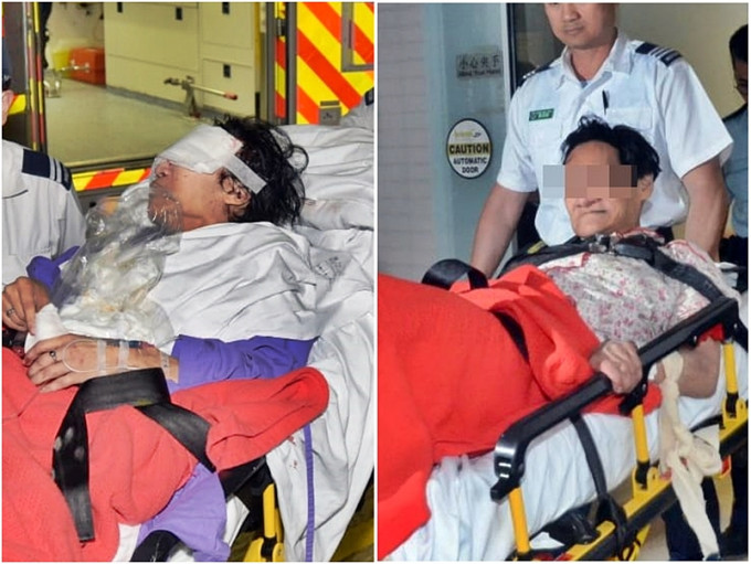 胞姊（左）左眼严重受伤、女疑犯（右）亦送院检验。