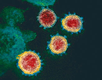 有專家指新冠病毒的「較弱版本」已在人群中傳播幾十年。
