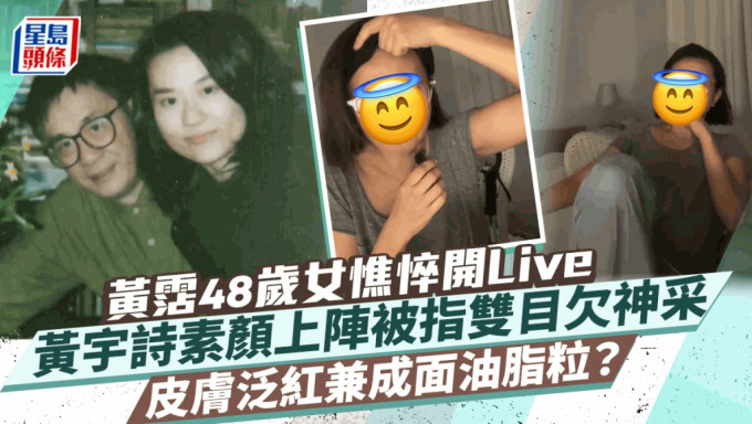 黃霑48歲女黃宇詩憔悴開Live成面油脂粒？ 素顏上陣皮膚泛紅被指雙目欠神采