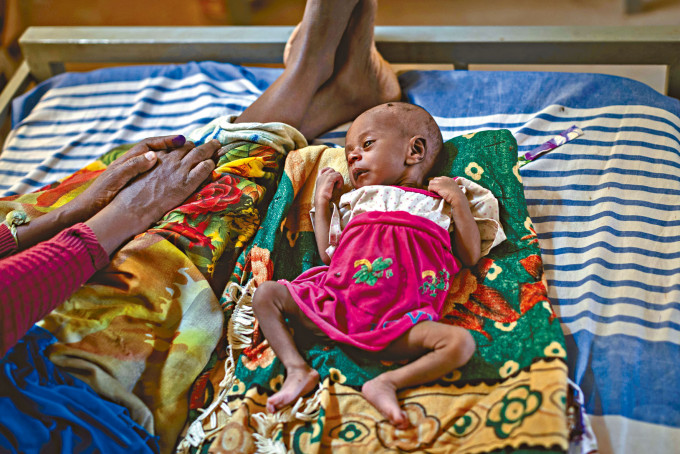 ■一个出生二十天的营养不良女婴，在提格雷地区接受治疗。