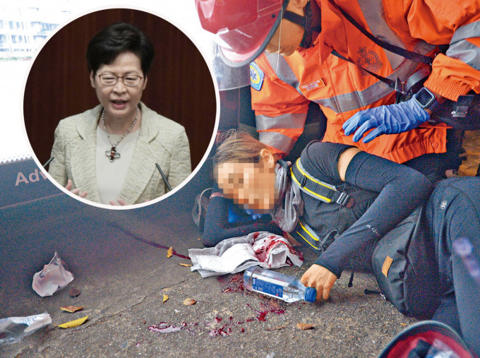 议员质疑「爆眼女」滥用法援，林郑月娥指，会检视法援制度。