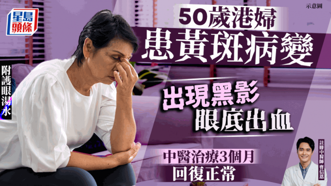 50歲港婦常捱夜患黃斑病變 出現黑影眼底出血 中醫治療3個月回復正常 附護眼湯水