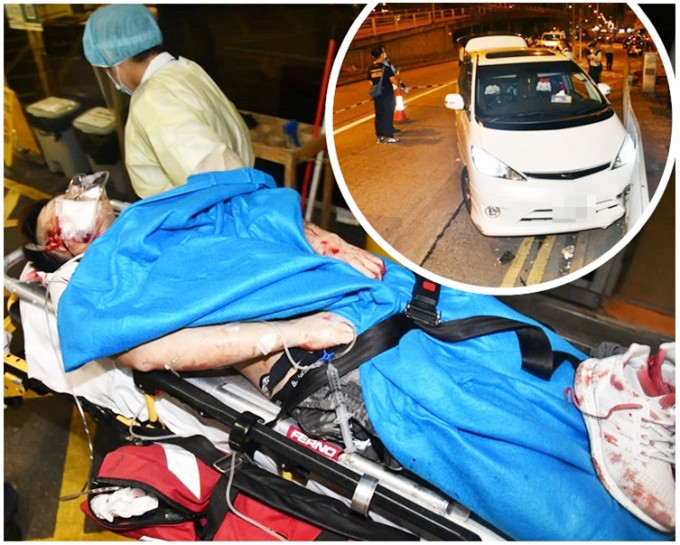 事主全身多處受傷，送往伊利沙伯醫院治理。小圖為涉案七人車。