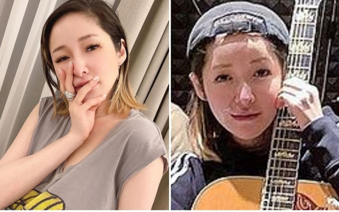 蕭亞軒昨晚貼短片，正面示人，清楚見到她右面上的疤痕。