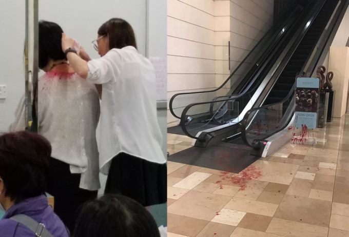 女子遭衣领及手部被红油溅中，事发的电梯旁亦遗下油迹。李子平摄、网上图片