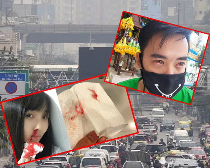 曼谷笼罩有毒雾霾中近1个月，当地有居民出现流鼻血、咳血、眼睛充血等症状。
