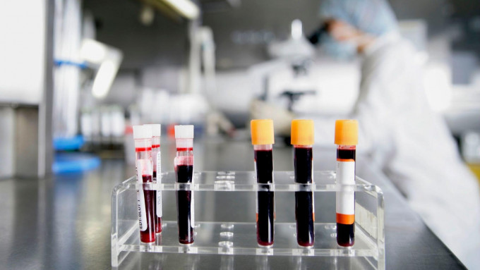 美研究指驗血可測八種常見癌症。網上圖片