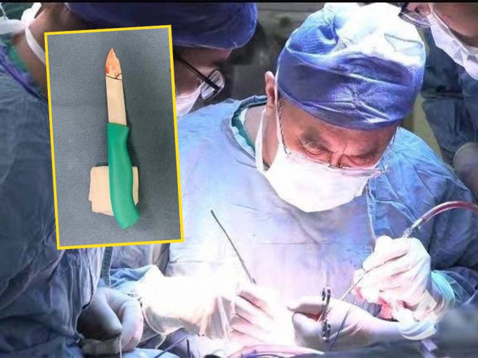 女童被陶瓷刀插入眼內，需要動手術取出碎片。互聯網圖片