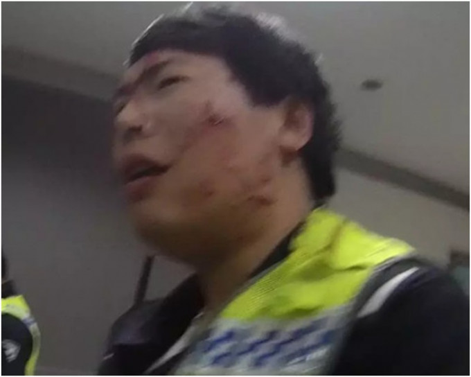 交警的臉部被抓傷。網圖