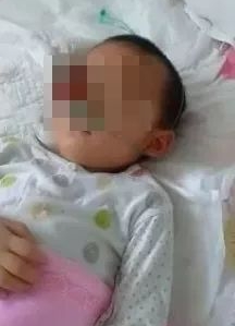 5月4日，病情被延误8个月后，3岁多的王凤雅离开了人世。（网图）