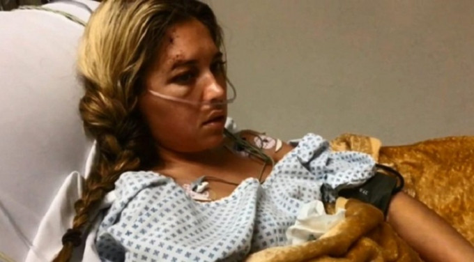 凱蒂日前到墨西哥玩滑翔傘慶生，詎料途中繩索意外斷裂，她也因此身受重傷。