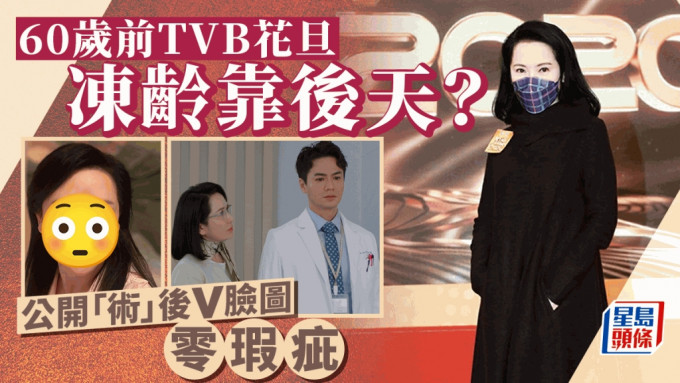 60岁前TVB花旦超冻龄有后天因素？公开「术」后变美图 离婚后想有个伴