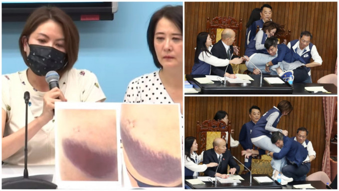 女议员陈菁徽（左）在记者会上公开照片，指受伤不轻。　台湾中时新闻网