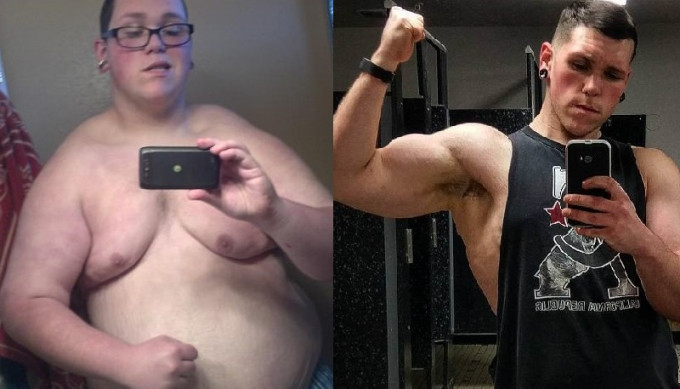 Zach Vogler在19岁时，体重已达463磅，如今已减至201磅。