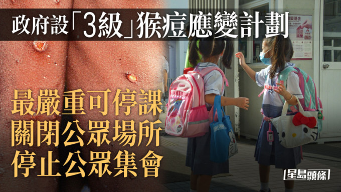 本港发现首宗猴痘输入个案，政府启动猴痘准备及应变计划下戒备级别。 资料图片