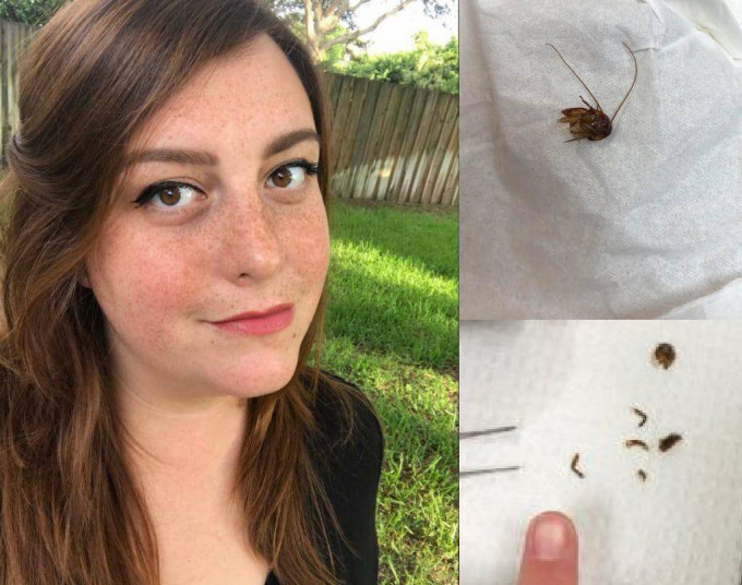 蟑螂跑进佛罗里达州女子霍利耳内。（网图）