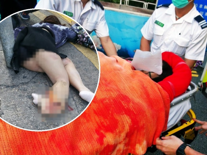 女伤者右脚被撞至血肉模糊，已送往医院治理。