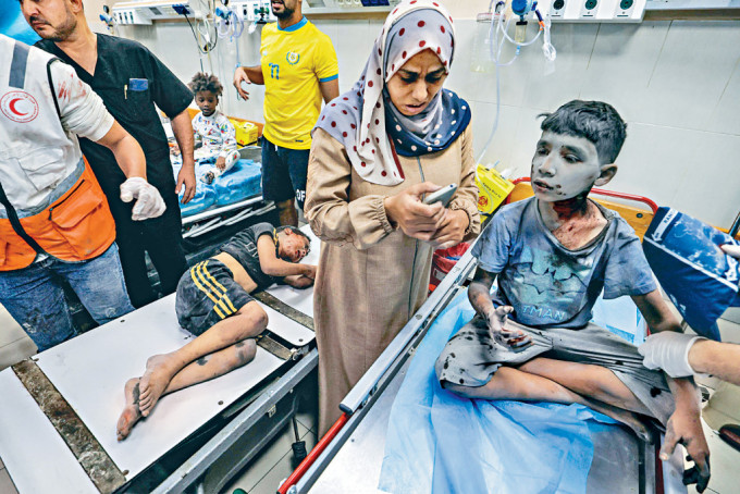 在以軍轟炸中受傷的巴勒斯坦小童，周二在加沙南部汗尤尼斯一間醫院接受急救。　