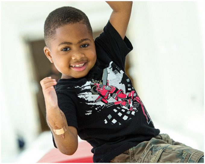 完成双手移植手术的10岁小童哈维 (Zion Harvey)。网上图片