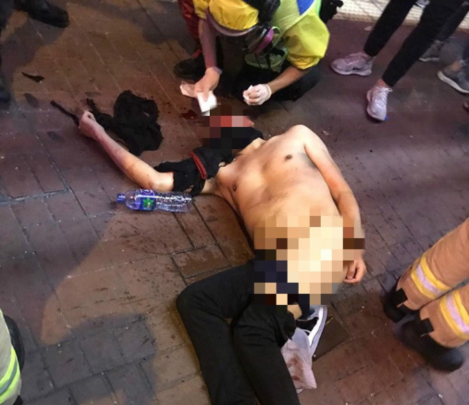 旺角男子被圍毆致私處外露。網上圖片