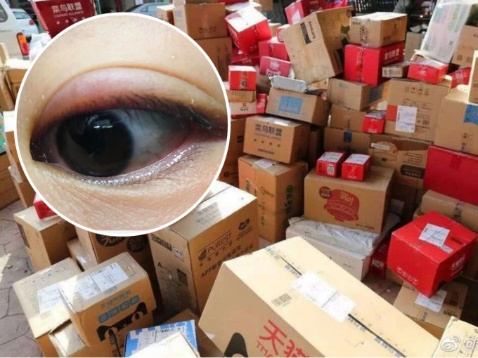 网民指收取包裹时捽了一下眼，即使眼红肿多时。