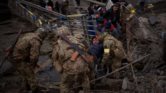 俄軍恢復進攻烏克蘭有平民在戰事中受傷。AP