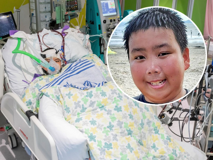 13岁少年阿峰患上罕见的扩张性心肌病变，致急性心衰竭。资料图片