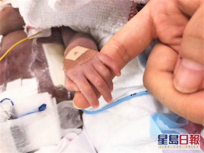 小秋彥病情惡化。FB圖片