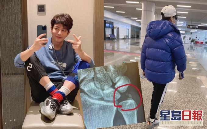 陳曉東為參與真人騷努力排練,在機場被發現手戴護具才透露傷勢。