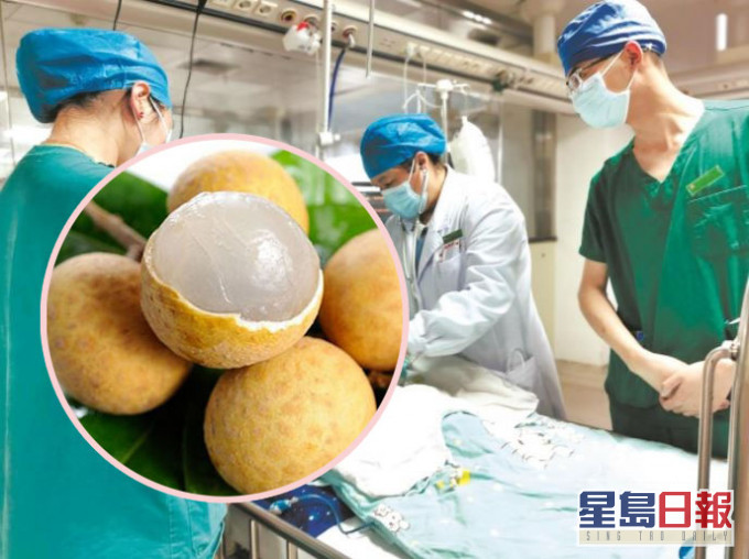 两岁女童吃龙眼鲠喉心脏骤停险死。