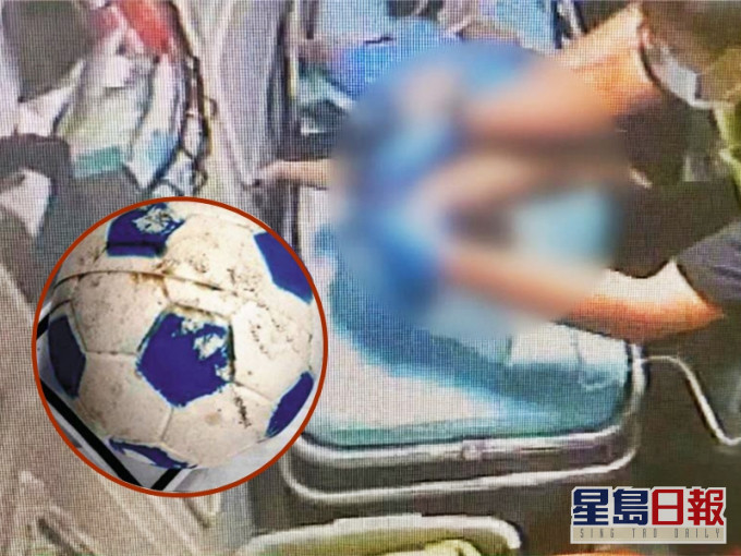 男童堅持21天後因缺氧性腦病變,恐無法復原,家屬只好決定忍痛拔喉。網圖