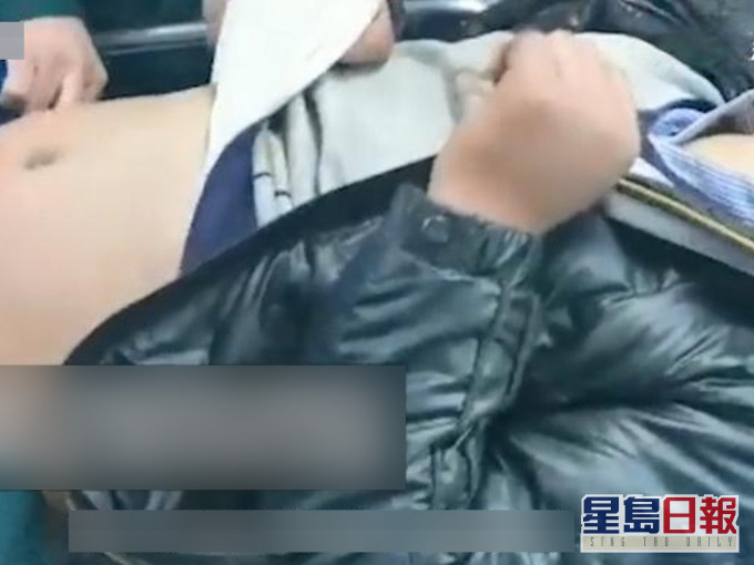 辽宁大连男子街头醉倒被冻僵,医生称手脚难保。(网图)