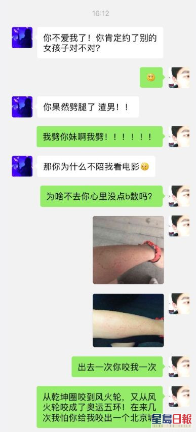 難忍女友愛咬人怪癖男子拒約會 都咬出奧運五環了 星島日報